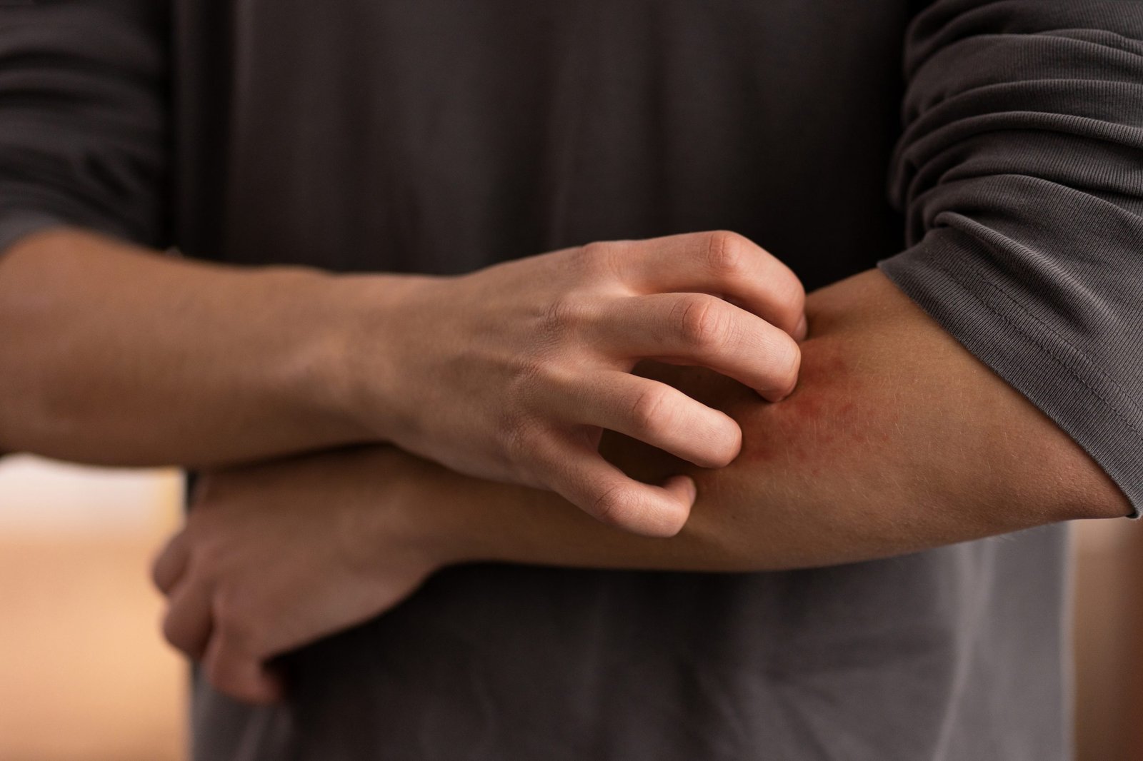 Person with skin irritation